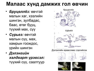Малаас хүнд дамжих гол өвчин
                                  бруцеллёз
• Бруцеллёз: өвчтэй
  малын хаг, хээлийн
  шингэн, зулбадас,
  баас, өтөг бууц,
  түүхий мах, сүү                   сүрьеэ
• Сүрьеэ: өвчтэй
  малын сүү, мах,
  хамрын гоождос,
  үрийн шингэн
                         Дэлэнгийн өрөвслөөс сэргийлэх
• Дэлэнгийн
  халдварт үрэвсэл:
  түүхий сүү, саалтуур
 