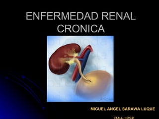 ENFERMEDAD RENAL CRONICA MIGUEL ANGEL SARAVIA LUQUE   FMH-UPSP 