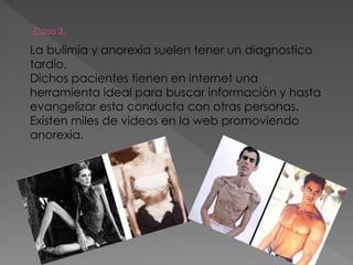 Caso 2.
La bulimia y anorexia suelen tener un diagnostico
tardío.
Dichos pacientes tienen en internet una
herramienta ideal para buscar información y hasta
evangelizar esta conducta con otras personas.
Existen miles de videos en la web promoviendo
anorexia.
 