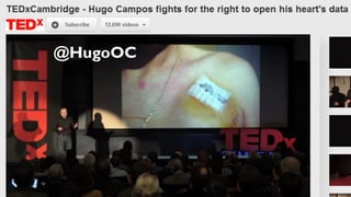 Hugo Campos wants his ICD data
@HugoOC
 
