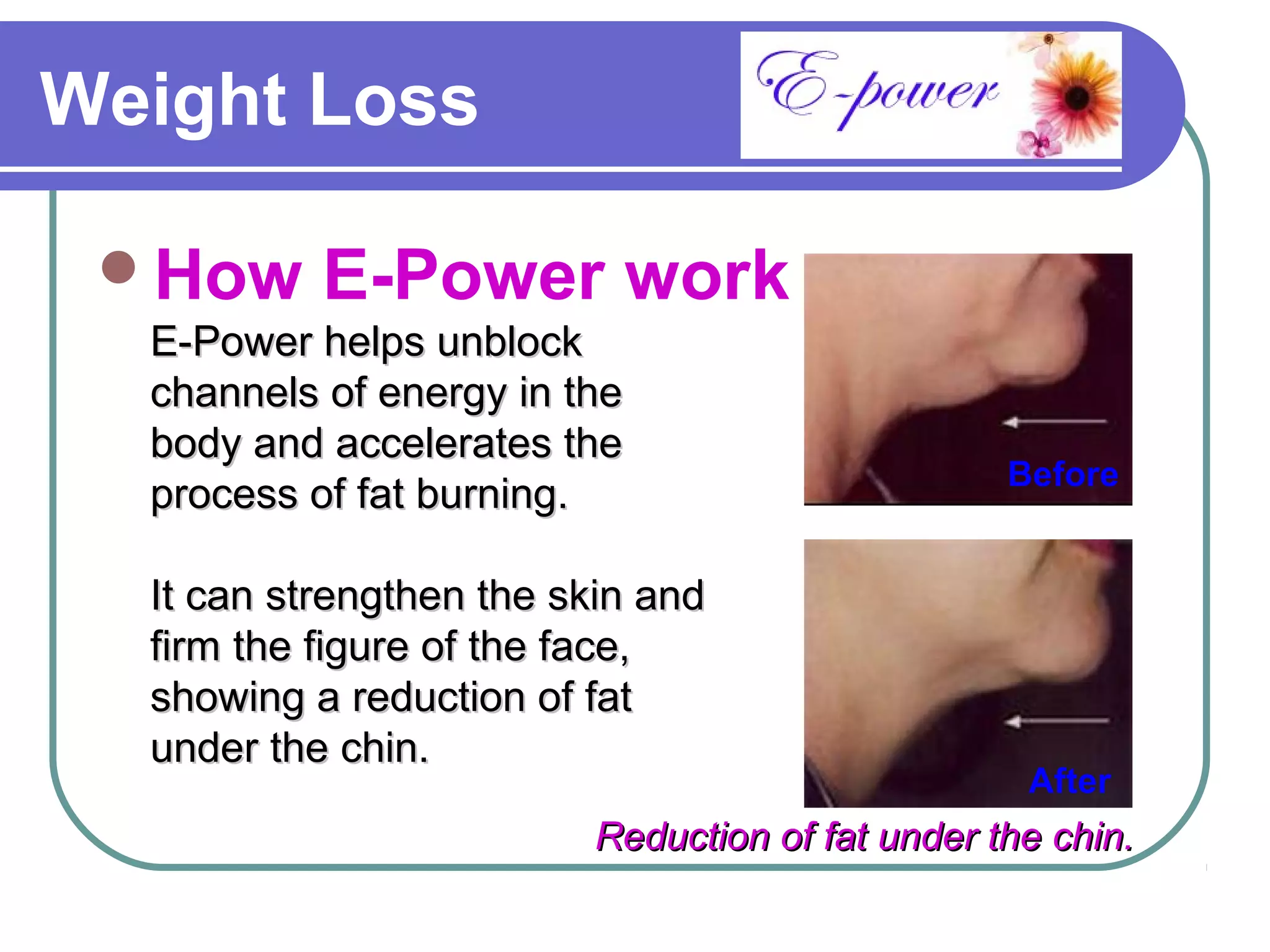 Weight Loss

 How      E-Power work
  E-Power helps unblock
  channels of energy in the
  body and accelerates the
                                                 Before
  process of fat burning.

  It can strengthen the skin and
  firm the figure of the face,
  showing a reduction of fat
  under the chin.
                                                  After
                         Reduction of fat under the chin.
 