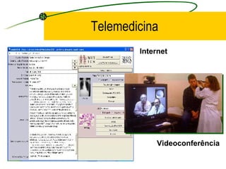 Telemedicina
Videoconferência
Internet
 