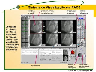 ConsultasConsultas
ao Bancoao Banco
de Dadosde Dados
adaptáveisadaptáveis
às necessi-às necessi-
dades , comdades , com
visualizaçãovisualização
imediata dosimediata dos
prontuprontuááriosrios
eletrônicoseletrônicos
Múltipla
visualização
de imagens
Salto de uma coleção
de imagens para outra
com apenas um click
Facilidade para
uso da Barra de
Ferramentas
Funções
agrupadas
por categorias
Prévisualização
Ajuste de
contraste
e Histograma
Acesso rápido
para ferramentas
standard
Sistema de Visualização em PACS
Fonte: WDS Technologies SA
 