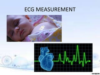 ECG MEASUREMENT
 