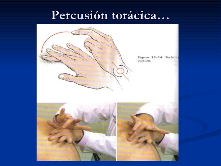 E X A M E N FÍ S I C O D E T O R A X