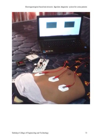 Electrogastrogram Machine Electrogastrogram based digestion detection system for coma patients | DOCX