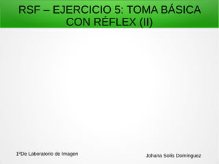 RSF – EJERCICIO 5: TOMA BÁSICA
CON RÉFLEX (II)
1ºDe Laboratorio de Imagen Johana Solís Domínguez
 