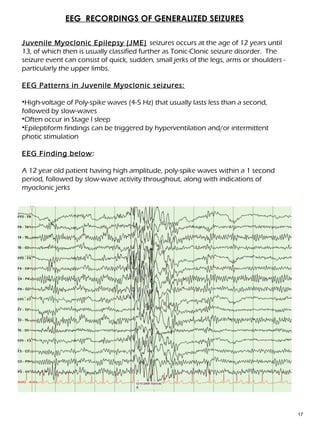 EEG & Epilepsy syndromes report [Autosaved] | PPT