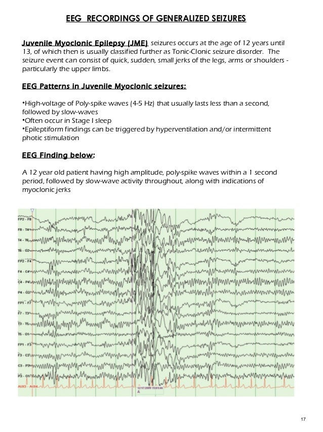 EEG & Epilepsy syndromes report [Autosaved]