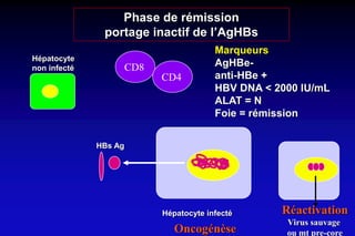 Hépatocyte infecté
HBs Ag
Hépatocyte
non infecté
Marqueurs
AgHBe-
anti-HBe +
HBV DNA < 2000 IU/mL
ALAT = N
Foie = rémission
Phase de rémission
portage inactif de l’AgHBs
Réactivation
Virus sauvage
ou mt pre-coreOncogénèse
CD8
CD4
 