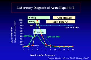 Laboratory Diagnosis of Acute Hepatitis B
0
100
200
300
400
500
600
700
800
900
1000
0 1 2 3 4 5 6 12 24 36 48 60
ALT
HBsAg
HBeAg
HBV DNA
Normal
Months After Exposure
Symptoms
Anti-HBs Ab
Anti-HBe Ab
IgM anti-HBc
Total anti-HBc
Seeger, Zoulim, Mason, Fields Virology 2007
 