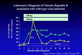 0
100
200
300
400
500
600
700
800
0 1 2 3 4 5 6 12 24 36 48 60
ALT
HBsAg
HBeAg
HBV DNA
Normal
Months After Exposure
Laboratory Diagnosis of Chronic Hepatitis B
associated with wild type virus infection
Seeger, Zoulim, Mason, Fields Virology 2007
 