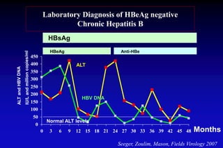 0
50
100
150
200
250
300
350
400
450
0 3 6 9 12 15 18 21 24 27 30 33 36 39 42 45 48
ALT
HBsAg
HBV DNA
Normal ALT levels
Months
Anti-HBeHBeAg
Laboratory Diagnosis of HBeAg negative
Chronic Hepatitis B
Seeger, Zoulim, Mason, Fields Virology 2007
 