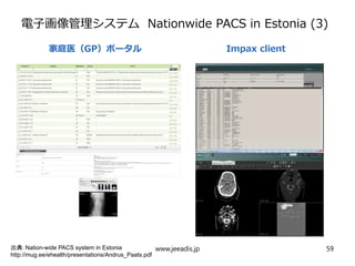 電子画像管理システム Nationwide PACS in Estonia (3)
出典：Nation-wide PACS system in Estonia
http://mug.ee/ehealth/presentations/Andrus_Paats.pdf
www.jeeadis.jp 59
家庭医（GP）ポータル Impax client
 