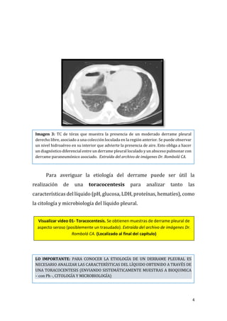 4
Para averiguar la etiología del derrame puede ser útil la
realización de una toracocentesis para analizar tanto las
características del líquido (pH, glucosa, LDH, proteínas, hematíes), como
la citología y microbiología del líquido pleural.
Imagen 3: TC de tórax que muestra la presencia de un moderado derrame pleural
derecho libre, asociado a una colección loculada en la región anterior. Se puede observar
un nivel hidroaéreo en su interior que advierte la presencia de aire. Esto obliga a hacer
un diagnóstico diferencial entre un derrame pleural loculado y un absceso pulmonar con
derrame paraneumónico asociado. Extraída del archivo de imágenes Dr. Rombolá CA.
LO IMPORTANTE: PARA CONOCER LA ETIOLOGÍA DE UN DERRAME PLEURAL ES
NECESARIO ANALIZAR LAS CARACTERÍSTICAS DEL LÍQUIDO OBTENIDO A TRAVÉS DE
UNA TORACOCENTESIS (ENVIANDO SISTEMÁTICAMENTE MUESTRAS A BIOQUIMICA
– con Ph -, CITOLOGÍA Y MICROBIOLOGÍA)
Visualizar video 01- Toracocentesis. Se obtienen muestras de derrame pleural de
aspecto seroso (posiblemente un trasudado). Extraída del archivo de imágenes Dr.
Rombolá CA. (Localizado al final del capítulo)
 