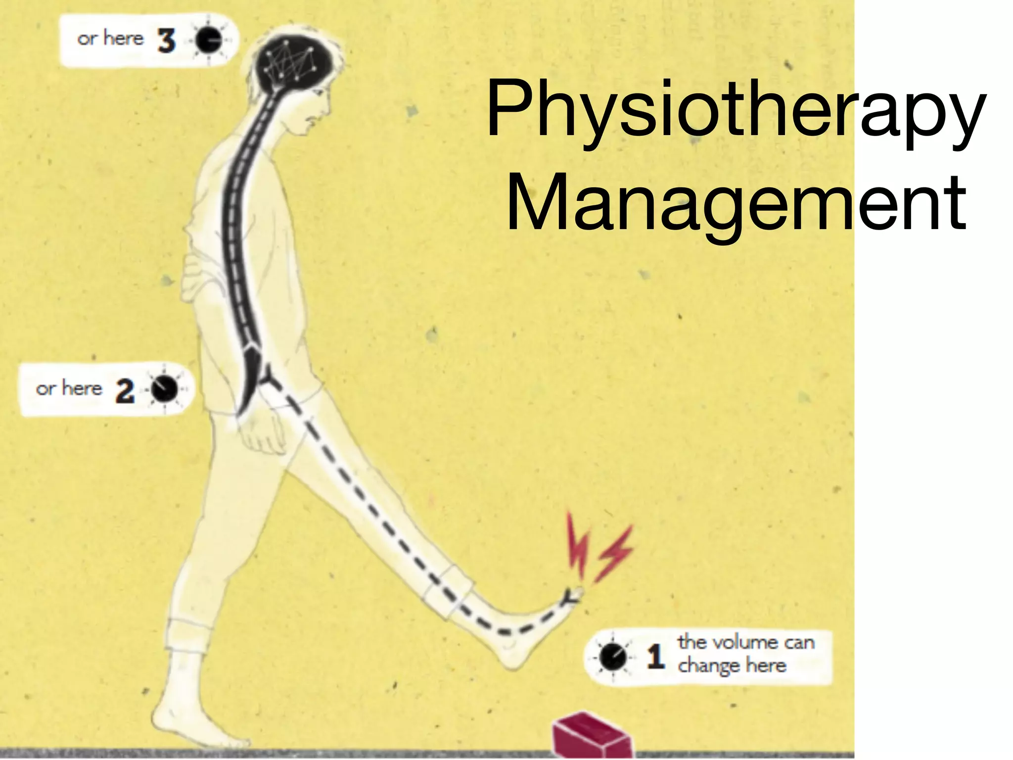 Physiotherapy
Management
 