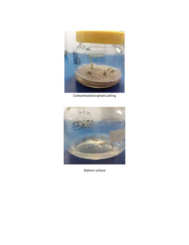 Effects of Bleaching Time and Bleach Concentrations on the Contaminat…