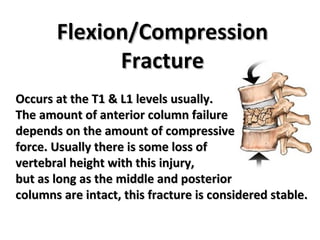 TL Spine Injury 2 | PPT