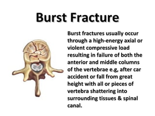 TL Spine Injury 2 | PPT