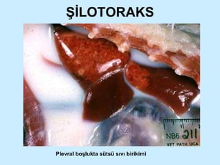 ŞİLOTORAKS Plevral boşlukta sütsü sıvı birikimi 