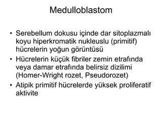 Medulloblastom Serebellum dokusu içinde dar sitoplazmalı koyu hiperkromatik nukleuslu (primitif) hücrelerin yoğun görüntüsü Hücrelerin küçük fibriler zemin etrafında veya damar etrafında belirsiz dizilimi (Homer-Wright rozet, Pseudorozet) Atipik primitif hücrelerde yüksek proliferatif aktivite 