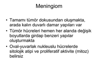 Meningiom Tamamı tümör dokusundan oluşmakta, arada kalın duvarlı damar yapıları var Tümör hücreleri hemen her alanda değişik boyutlarda girdap benzeri yapılar oluşturmakta Oval-yuvarlak nukleuslu hücrelerde sitolojik atipi ve proliferatif aktivite (mitoz) belirsiz 