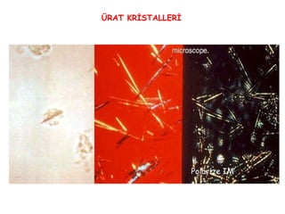 ÜRAT KRİSTALLERİ Polarize IM 