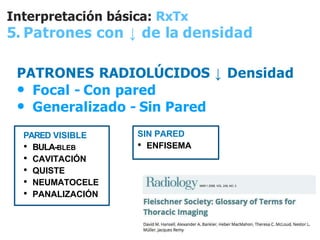 Rrx de torax  interpretación y ej. de patologías, Clase de unam