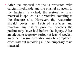 • After the exposed dentine is protected with
calcium hydroxide and the enamel adjacent to
the fracture is etched, the restorative resin
material is applied as a protective covering at
the fracture site. However, the restoration
should cover the fractured surfaces and
maintain any natural proximal contacts the
patient may have had before the injury. After
an adequate recovery period (at least 4 weeks),
an esthetic resin restoration may be completed,
often without removing all the temporary resin
material.
 