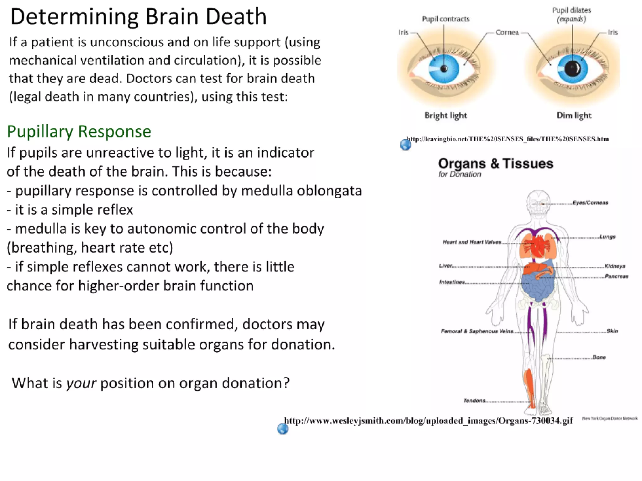Slide 17