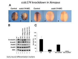 Early neural differentiation markers
ccdc174 knockdown in Xenopus
 
