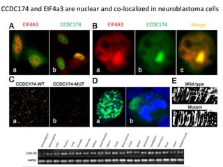 CCDC174
CCDC174 and EIF4a3 are nuclear and co-localized in neuroblastoma cells
EIF4A3 CCDC174 CCDC174EIF4A3 Merge
 