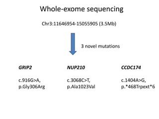 Whole-exome sequencing
Chr3:11646954-15055905 (3.5Mb)
3 novel mutations
GRIP2
c.916G>A,
p.Gly306Arg
NUP210
c.3068C>T,
p.Ala1023Val
CCDC174
c.1404A>G,
p.*468Trpext*6
 