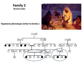 Family 2
Muslim Arabs
Hypotonia phenotype similar to family 1
 