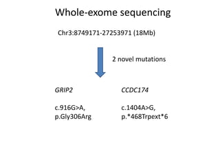 Whole-exome sequencing
Chr3:8749171-27253971 (18Mb)
2 novel mutations
GRIP2
c.916G>A,
p.Gly306Arg
CCDC174
c.1404A>G,
p.*468Trpext*6
 
