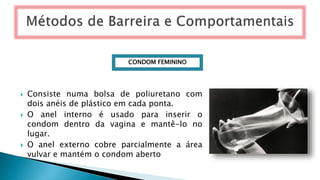  Consiste numa bolsa de poliuretano com
dois anéis de plástico em cada ponta.
 O anel interno é usado para inserir o
condom dentro da vagina e mantê-lo no
lugar.
 O anel externo cobre parcialmente a área
vulvar e mantém o condom aberto
CONDOM FEMININO
 
