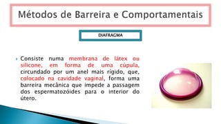  Consiste numa membrana de látex ou
silicone, em forma de uma cúpula,
circundado por um anel mais rígido, que,
colocado na cavidade vaginal, forma uma
barreira mecânica que impede a passagem
dos espermatozóides para o interior do
útero.
DIAFRAGMA
 