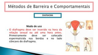 Modo de uso
 O diafragma deve ser inserido na hora da
relação sexual ou até uma hora antes.
Primeiramente deve ser colocado
espermaticida nas bordas e no lado
côncavo do diafragma.
DIAFRAGMA
 