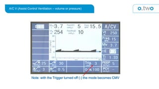 A/C V (Assist Control Ventilation – volume or pressure)
Note: with the Trigger turned off (-) the mode becomes CMV
 