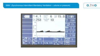 SIMV (Synchronous Intermittent Mandatory Ventilation – volume or pressure)
 