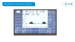 BiLVL (Bi-phasic Positive Airway Pressure)
 