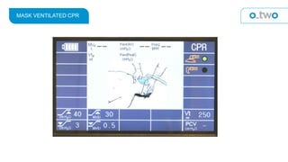 MASK VENTILATED CPR
 