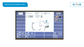 PROTECTED AIRWAY CPR
 