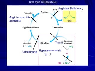 Urea cycle defects (UCDs)
 
