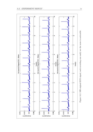 A.2. EXPERIMENT RESULT iv
FigureA.2:MHoriginalECGsignal,eachrecordingcaneasilyseethenoiseisnoticeable.
 