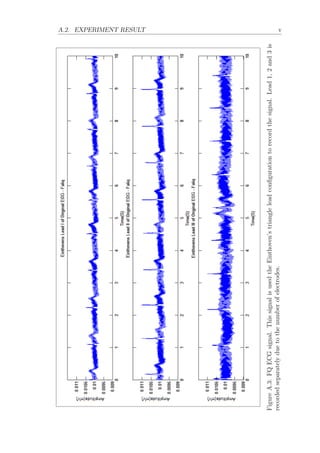 A.2. EXPERIMENT RESULT v
FigureA.3:FQECGsignal.ThissignalisusedtheEinthoven’striangleleadconﬁgurationtorecordthesignal.Lead1,2and3is
recordedseparatelyduetothenumberofelectrodes.
 