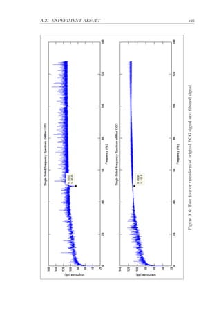 A.2. EXPERIMENT RESULT viii
FigureA.6:FastfouriortransformoforiginalECGsignalandﬁlteredsignal.
 
