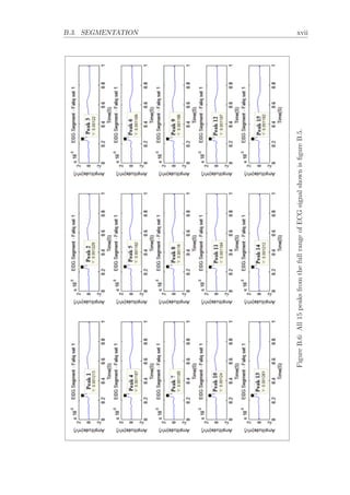 B.3. SEGMENTATION xvii
FigureB.6:All15peaksfromthefullrangeofECGsignalshownisﬁgureB.5.
 