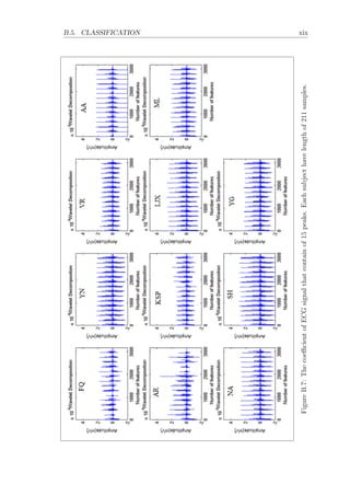 B.5. CLASSIFICATION xix
FigureB.7:ThecoeﬃcientofECGsignalthatcontainof15peaks.Eachsubjecthavelengthof211samples.
 