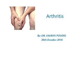 Arthritis
By:DR.SAURAVPOUDEL
30thOctober2016
 